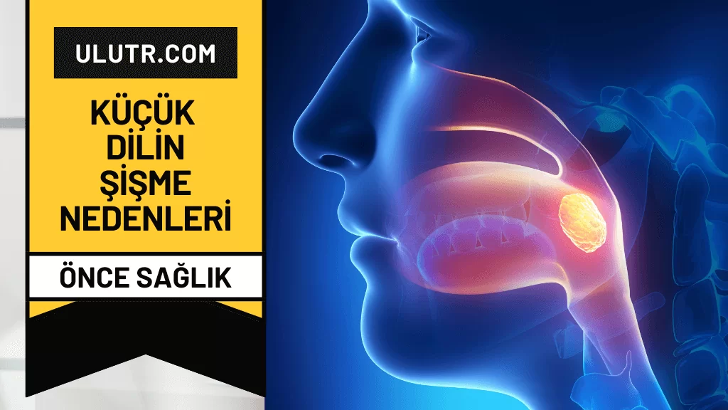 küçük dilin şişme nedenleri